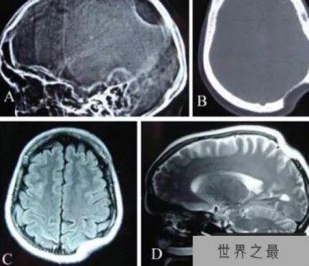 ​关于人类骨骼的十大事实,人类骨骼有这么多的谜团